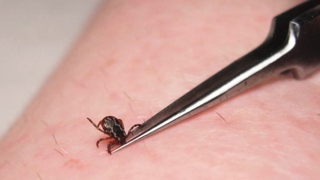 Bush Craft: Ticks & Tick Bites